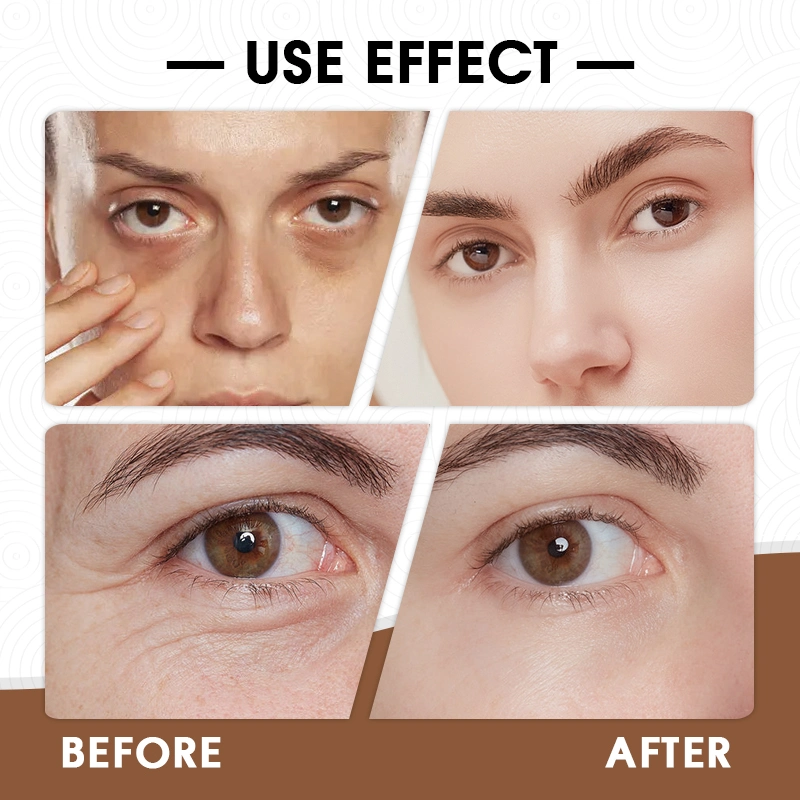 The Eye Concentrate Moisturizing Intense Snail Eye Cream Anti-Aging Anti-Wrinkle