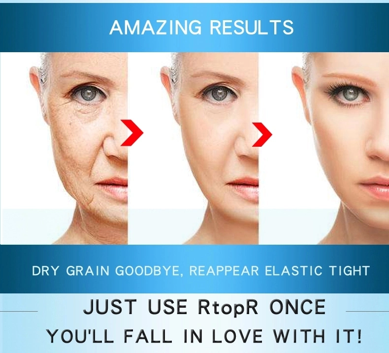 Rtopr Eye Care Anti Aging Ageless Dark Circles Removal Anti Puffiness Firming Lifting Natural Organic Mango Eye Cream