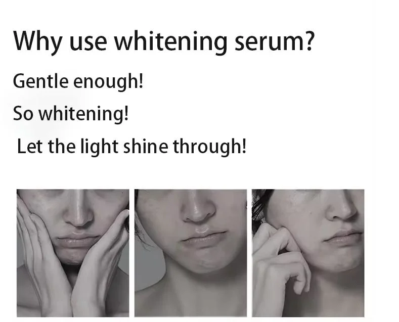 New Product Recommend Removal Dark Spot Face Moisturizing Serum Shrinking Pores Oil Control Whitening Nicotinamide Facial Serum