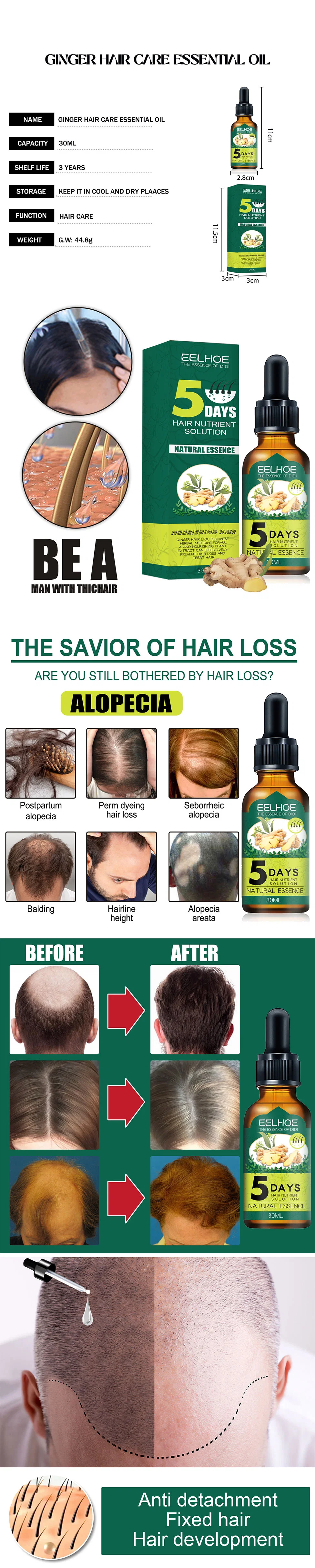 5 Days Anti Hair Loss Prevent Baldness Treatment Fast Growing Nourish Dry Damaged Ginger Hair Care Essential Oil