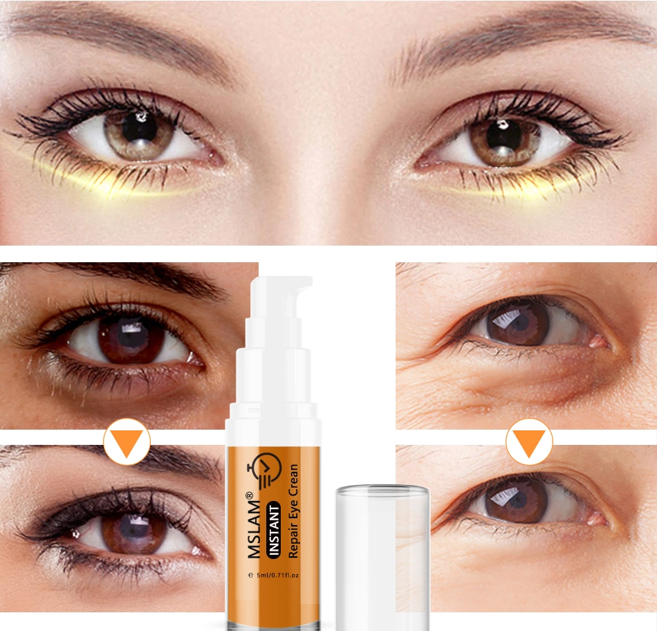 Mslam Instant Repair Eye Cream Remove Dark Circles Fine Lines Eye Bag Against Aging Deep Moisturizing Eye Cream