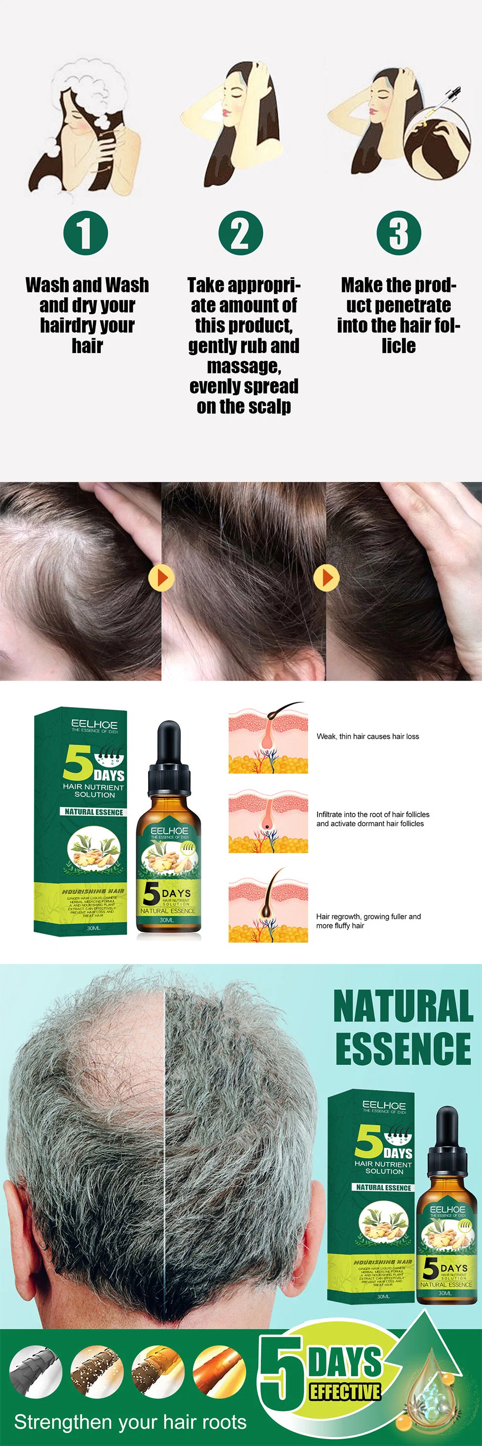 5 Days Anti Hair Loss Prevent Baldness Treatment Fast Growing Nourish Dry Damaged Ginger Hair Care Essential Oil