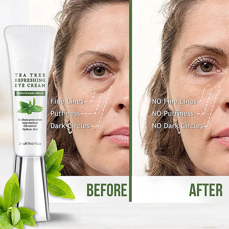 Custom Premium Natural Tea Tree Moisturizing Antioxidant Wrinkles Eye Cream