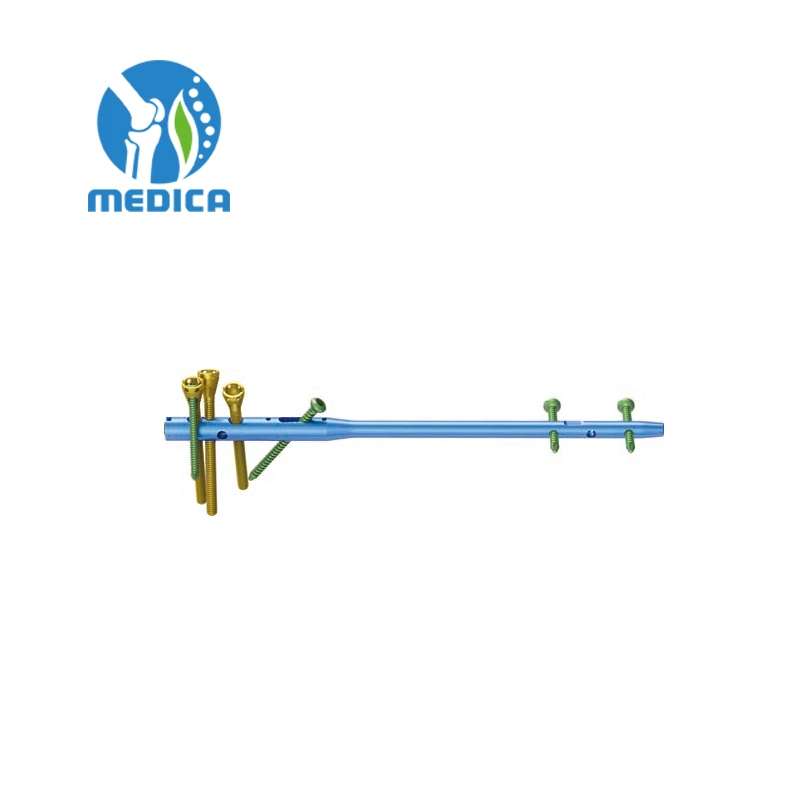 Orthopedic Trauma Implant Pfna Interlocking Nail-II